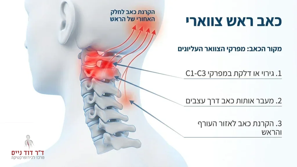 אחרי הפסקה המסבירה מהו כאב ראש צווארי והמנגנון האנטומי שלו. אילוסטרציה רפואית של עמוד השדרה הצווארי והקרנת כאב לראש